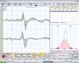 Open bite Jaw jerk.jpg