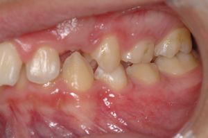 OrtoNeuroGnatodonzia 3.jpg