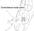 Controlateral molar point.jpeg