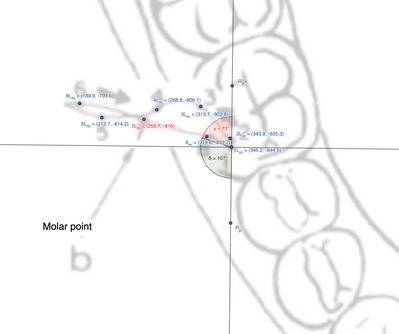 Figura 3: Distanze e direzioni del molare ipsilaterale alla laterotrusione