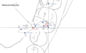 Figura molare mediotrusivo.jpg