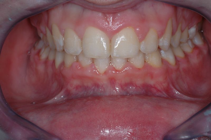 File:Aspetto frontale del caso clinico finalizzato.jpg